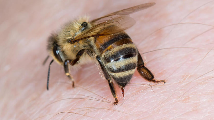 Что делать если ужалила пчела?